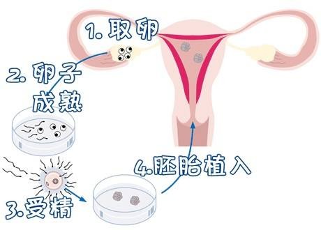 高龄代怀服务微信群门诊